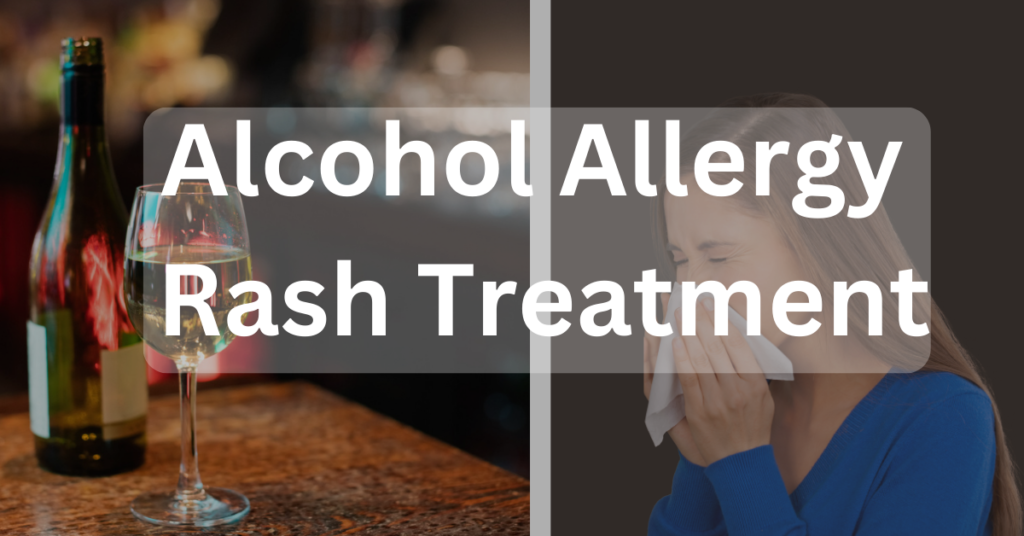Alcohol Allergy Rash Treatment